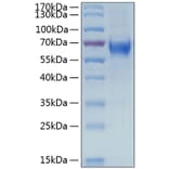 SDS-PAGE - Recombinant Human IL-6R Protein (C-terminal His Tag) (A330921) - Antibodies.com
