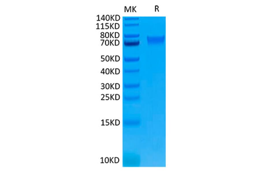 Tris-Bis PAGE - Recombinant Human IL-6R Protein (Biotin) (C-terminal His and Avi Tag) (A330922) - Antibodies.com