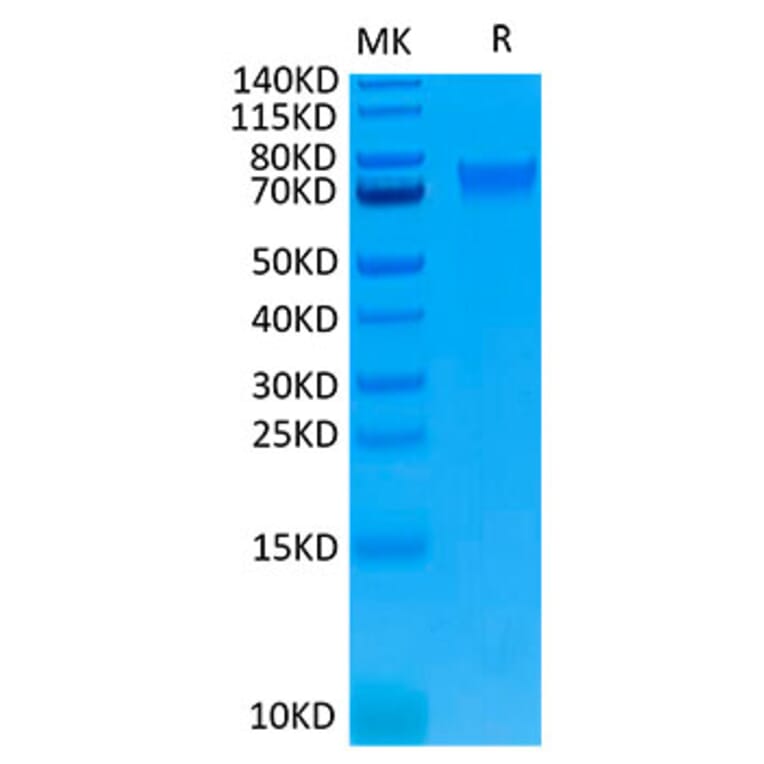 Tris-Bis PAGE - Recombinant Human IL-6R Protein (Biotin) (C-terminal His and Avi Tag) (A330922) - Antibodies.com