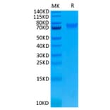 Tris-Bis PAGE - Recombinant Human IL-6R Protein (Biotin) (C-terminal His and Avi Tag) (A330922) - Antibodies.com