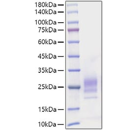 SDS-PAGE - Recombinant Mouse IL-7 Protein (C-terminal His Tag) (A330923) - Antibodies.com