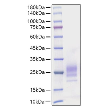 SDS-PAGE - Recombinant Mouse IL-7 Protein (C-terminal His Tag) (A330923) - Antibodies.com