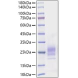 SDS-PAGE - Recombinant Mouse IL-7 Protein (C-terminal His Tag) (A330923) - Antibodies.com