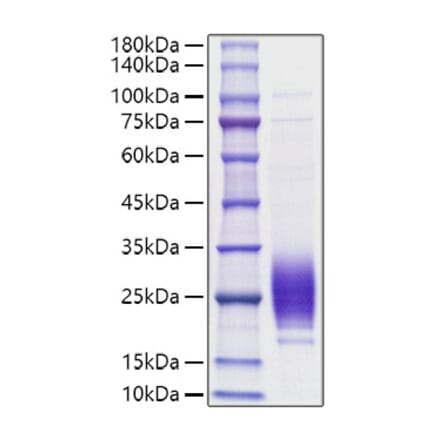 SDS-PAGE - Recombinant Rat IL-7 Protein (C-terminal His Tag) (A330924) - Antibodies.com