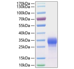 SDS-PAGE - Recombinant Human IL-7 Protein (C-terminal His Tag) (A330925) - Antibodies.com