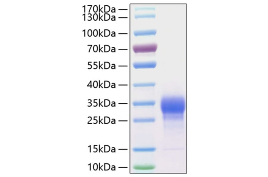 SDS-PAGE - Recombinant Human IL-7 Protein (C-terminal His Tag) (A330925) - Antibodies.com