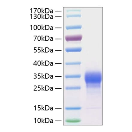 SDS-PAGE - Recombinant Human IL-7 Protein (C-terminal His Tag) (A330925) - Antibodies.com