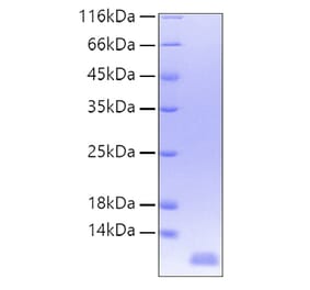 SDS-PAGE - Recombinant Human IL-8 Protein (A330926) - Antibodies.com