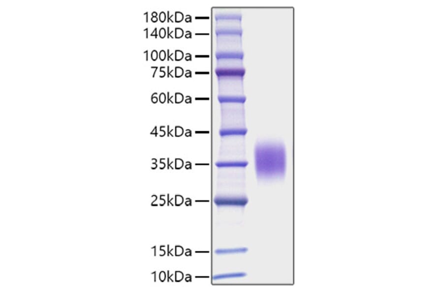SDS-PAGE - Recombinant Mouse IL-9 Protein (C-terminal His Tag) (A330928) - Antibodies.com