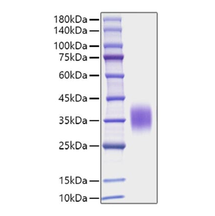 SDS-PAGE - Recombinant Mouse IL-9 Protein (C-terminal His Tag) (A330928) - Antibodies.com