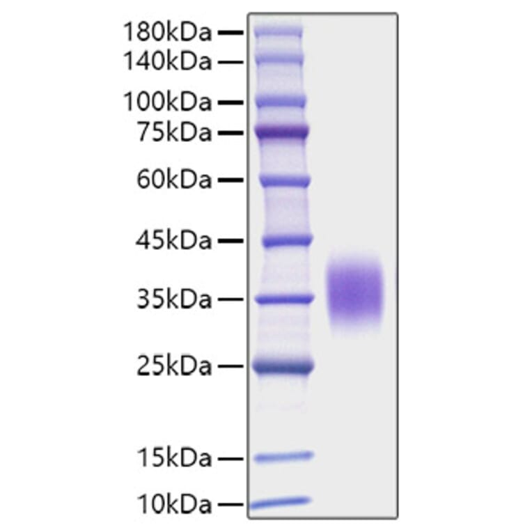 SDS-PAGE - Recombinant Mouse IL-9 Protein (C-terminal His Tag) (A330928) - Antibodies.com