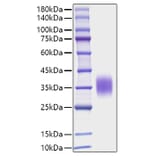SDS-PAGE - Recombinant Mouse IL-9 Protein (C-terminal His Tag) (A330928) - Antibodies.com