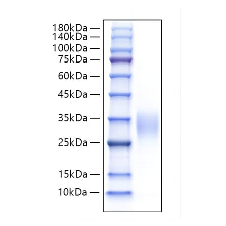 SDS-PAGE - Recombinant Human IL-9 Protein (A330929) - Antibodies.com