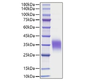 SDS-PAGE - Recombinant Human IL-9 Protein (C-terminal His Tag) (A330930) - Antibodies.com