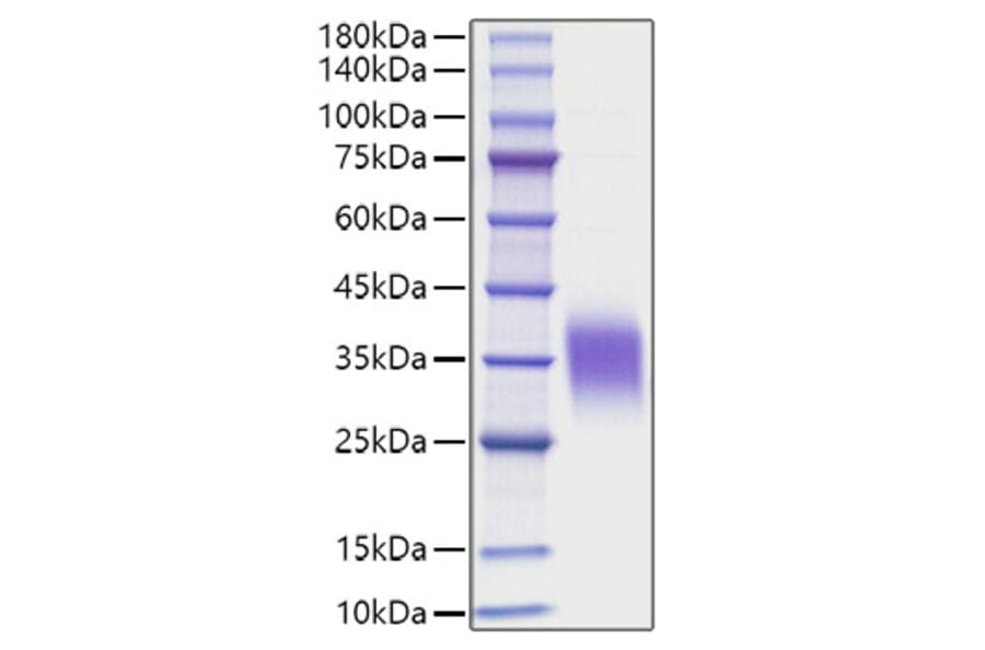 SDS-PAGE - Recombinant Human IL-9 Protein (C-terminal His Tag) (A330930) - Antibodies.com