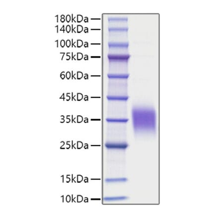 SDS-PAGE - Recombinant Human IL-9 Protein (C-terminal His Tag) (A330930) - Antibodies.com