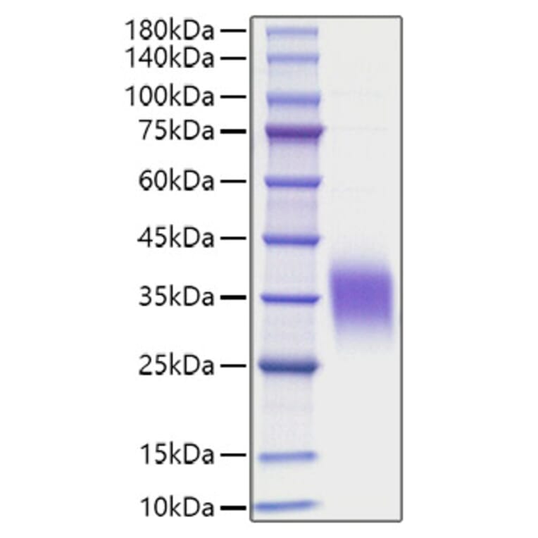 SDS-PAGE - Recombinant Human IL-9 Protein (C-terminal His Tag) (A330930) - Antibodies.com