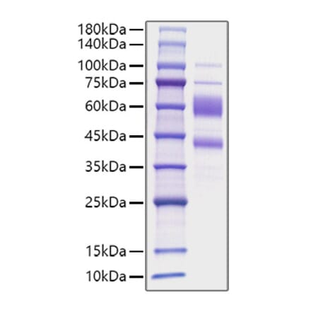 SDS-PAGE - Recombinant Human IL-9 Protein (C-terminal Human Fc Tag) (A330931) - Antibodies.com
