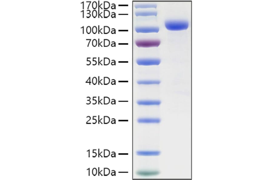 SDS-PAGE - Recombinant Human ILT-4 Protein (C-terminal Human Fc and His Tag) (A330932) - Antibodies.com