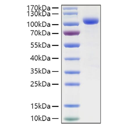 SDS-PAGE - Recombinant Human ILT-4 Protein (C-terminal Human Fc and His Tag) (A330932) - Antibodies.com