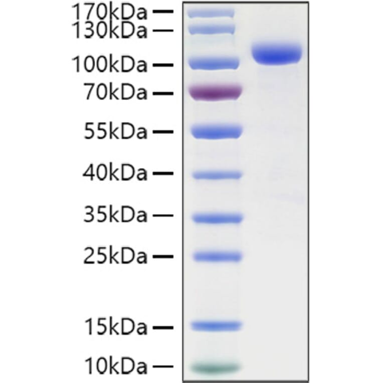 SDS-PAGE - Recombinant Human ILT-4 Protein (C-terminal Human Fc and His Tag) (A330932) - Antibodies.com