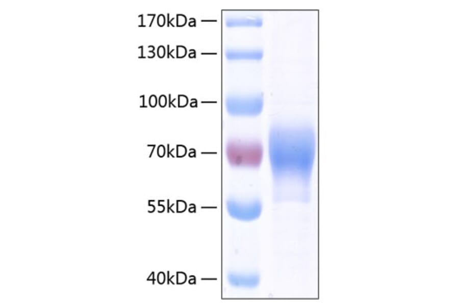 SDS-PAGE - Recombinant Human ILT-4 Protein (C-terminal His Tag) (A330933) - Antibodies.com