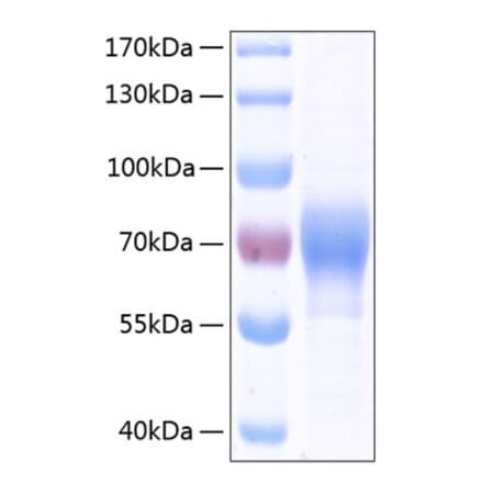 SDS-PAGE - Recombinant Human ILT-4 Protein (C-terminal His Tag) (A330933) - Antibodies.com