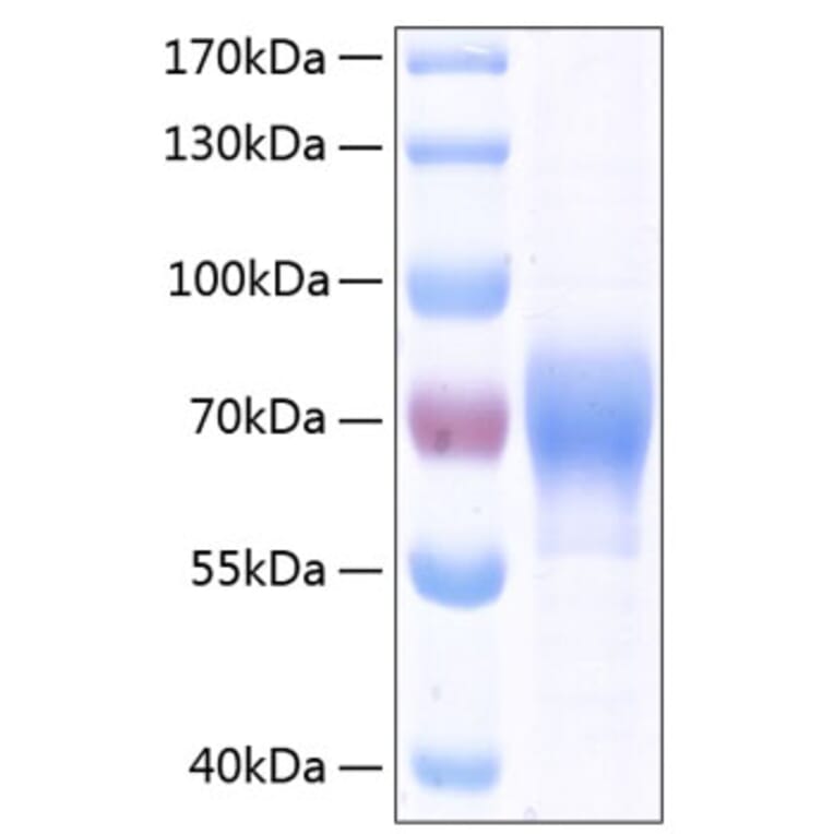 SDS-PAGE - Recombinant Human ILT-4 Protein (C-terminal His Tag) (A330933) - Antibodies.com