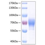 SDS-PAGE - Recombinant Human ILT-4 Protein (C-terminal His Tag) (A330933) - Antibodies.com