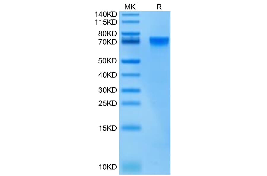 Tris-Bis PAGE - Recombinant Human ILT-4 Protein (Biotin) (C-terminal His and Avi Tag) (A330934) - Antibodies.com