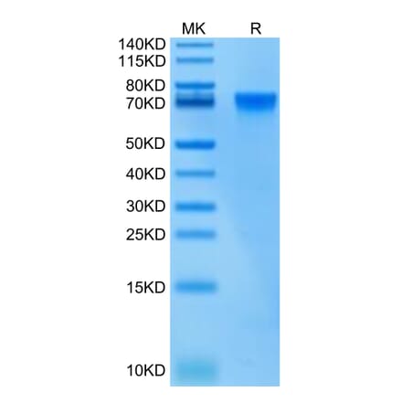 Tris-Bis PAGE - Recombinant Human ILT-4 Protein (Biotin) (C-terminal His and Avi Tag) (A330934) - Antibodies.com