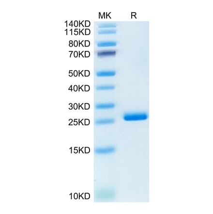 Tris-Bis PAGE - Recombinant Human ILT-4 Protein (C-terminal His Tag) (A330935) - Antibodies.com