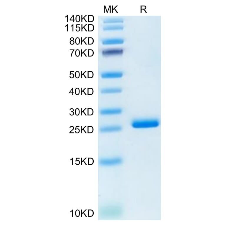 Tris-Bis PAGE - Recombinant Human ILT-4 Protein (C-terminal His Tag) (A330935) - Antibodies.com