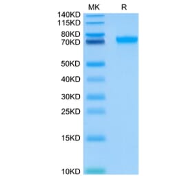 Tris-Bis PAGE - Recombinant Human ILT-4 Protein (C-terminal His and Avi Tag) (A330936) - Antibodies.com