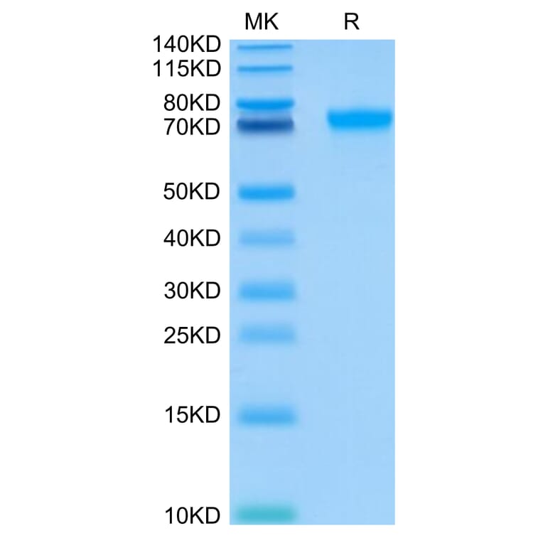 Tris-Bis PAGE - Recombinant Human ILT-4 Protein (C-terminal His and Avi Tag) (A330936) - Antibodies.com