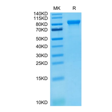 Tris-Bis PAGE - Recombinant Human ILT-4 Protein (C-terminal Human Fc Tag) (A330937) - Antibodies.com