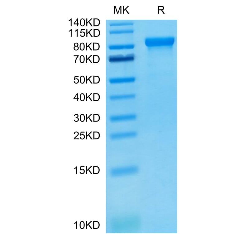 Tris-Bis PAGE - Recombinant Human ILT-4 Protein (C-terminal Human Fc Tag) (A330937) - Antibodies.com
