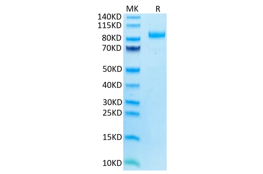Tris-Bis PAGE - Recombinant Human ILT-4 Protein (C-terminal Mouse Fc Tag) (A330938) - Antibodies.com