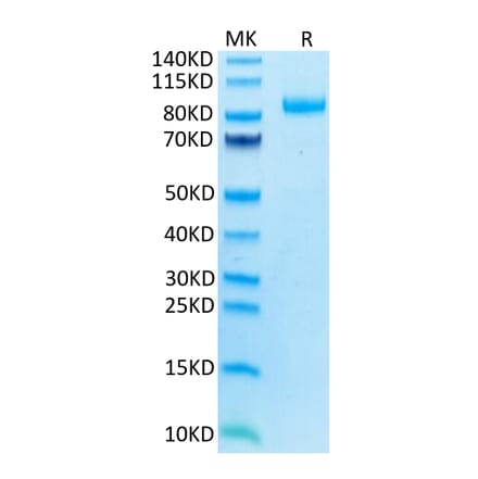 Tris-Bis PAGE - Recombinant Human ILT-4 Protein (C-terminal Mouse Fc Tag) (A330938) - Antibodies.com