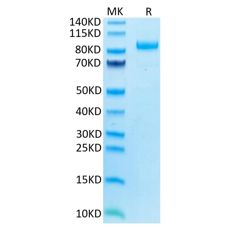 Tris-Bis PAGE - Recombinant Human ILT-4 Protein (C-terminal Mouse Fc Tag) (A330938) - Antibodies.com