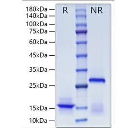 SDS-PAGE - Recombinant Human Inhibin beta A Protein (A330939) - Antibodies.com