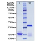 SDS-PAGE - Recombinant Human Inhibin beta A Protein (A330939) - Antibodies.com