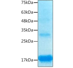 SDS-PAGE - Recombinant Human Inhibin beta A Protein (C-terminal His Tag) (A330940) - Antibodies.com