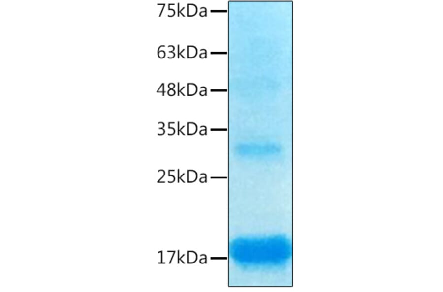 SDS-PAGE - Recombinant Human Inhibin beta A Protein (C-terminal His Tag) (A330940) - Antibodies.com