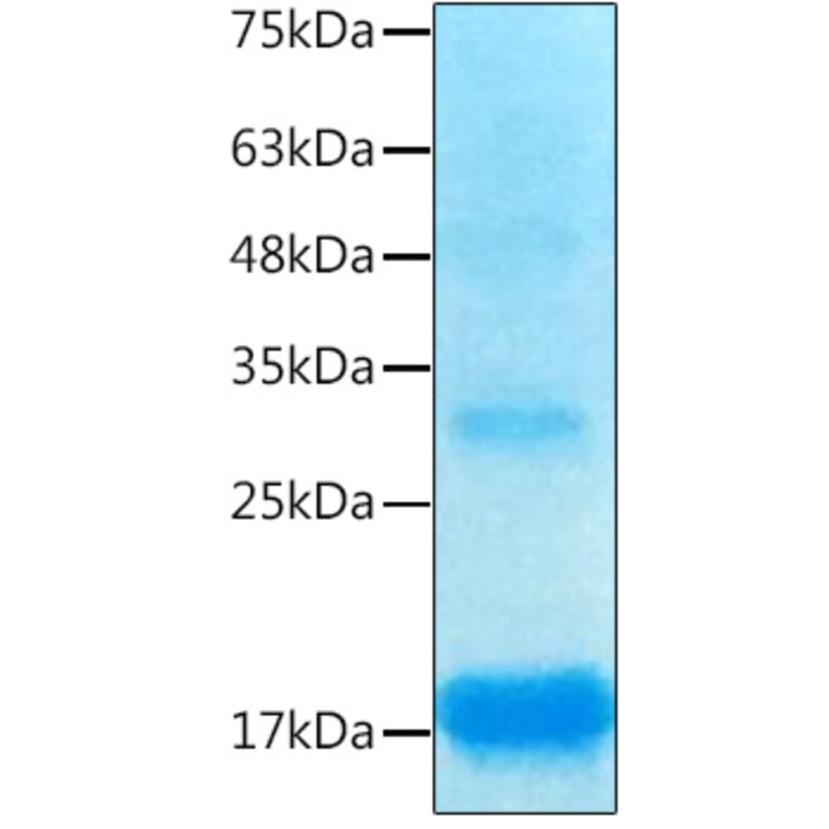SDS-PAGE - Recombinant Human Inhibin beta A Protein (C-terminal His Tag) (A330940) - Antibodies.com