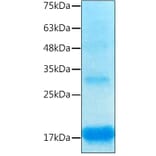 SDS-PAGE - Recombinant Human Inhibin beta A Protein (C-terminal His Tag) (A330940) - Antibodies.com