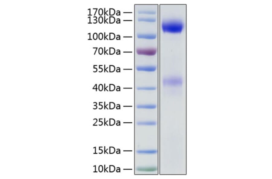 SDS-PAGE - Recombinant Human Insulin Receptor Protein (C-terminal His Tag) (A330942) - Antibodies.com