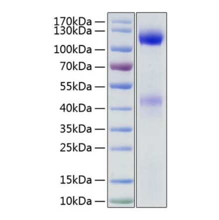 SDS-PAGE - Recombinant Human Insulin Receptor Protein (C-terminal His Tag) (A330942) - Antibodies.com