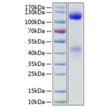 SDS-PAGE - Recombinant Human Insulin Receptor Protein (C-terminal His Tag) (A330942) - Antibodies.com