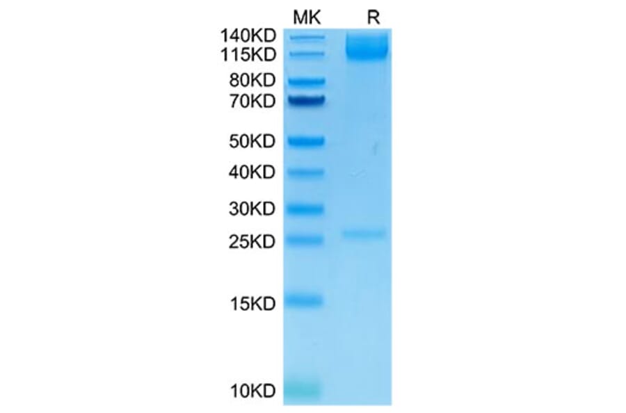 Tris-Bis PAGE - Recombinant Human Integrin alpha 5 + Integrin beta 1 Protein (C-terminal His and Avi Tag) (A330943) - Antibodies.com